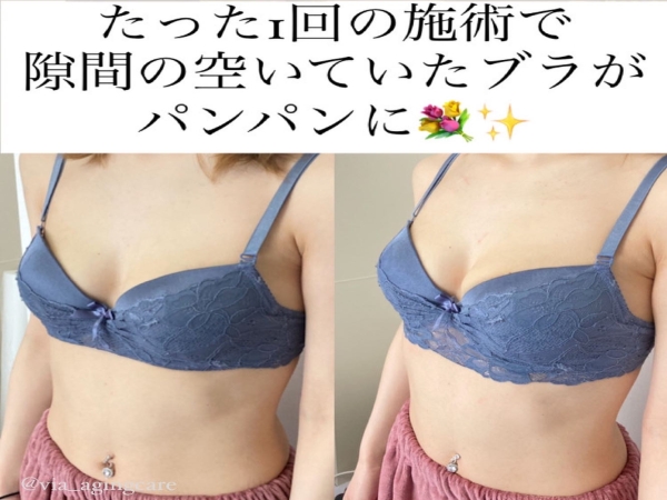 エステサロンの代理店パートナー